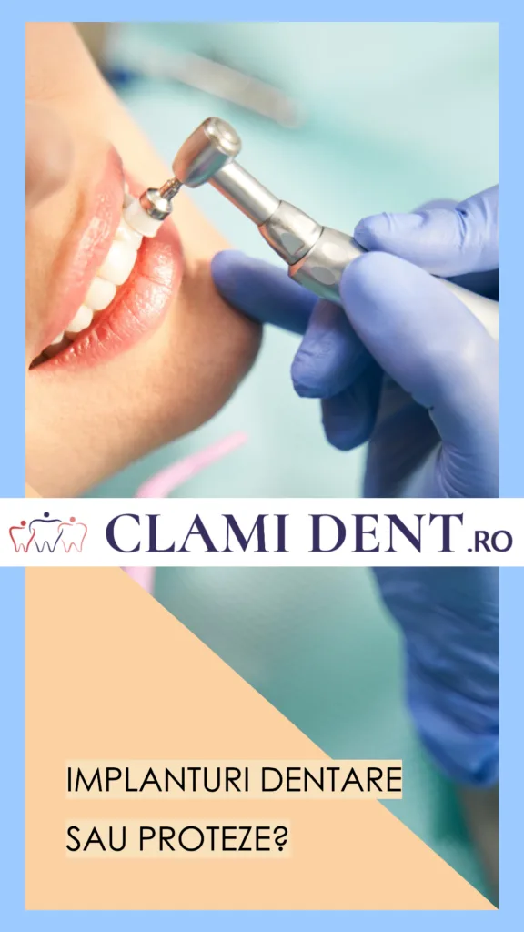 Implant dentar vs. proteză mobilă