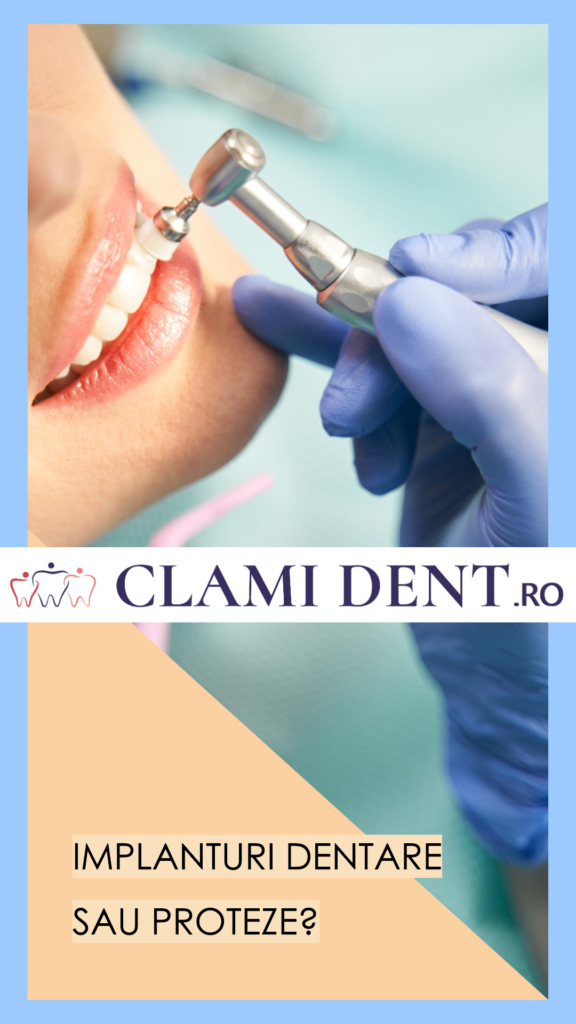 Implant dentar vs. proteză mobilă