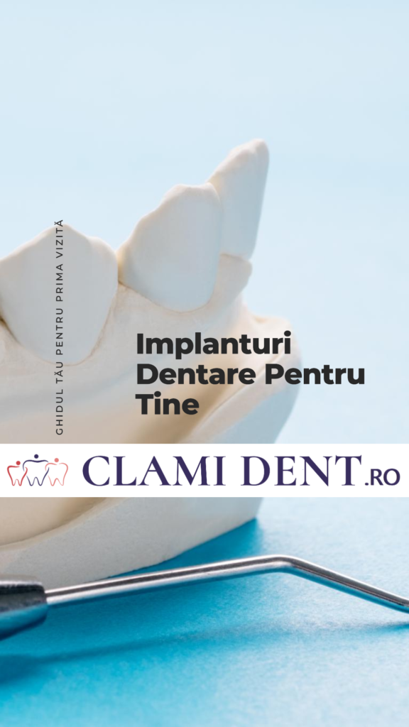 Implanturi Dentare Ghid Complet pentru Prima Vizită la Specialist