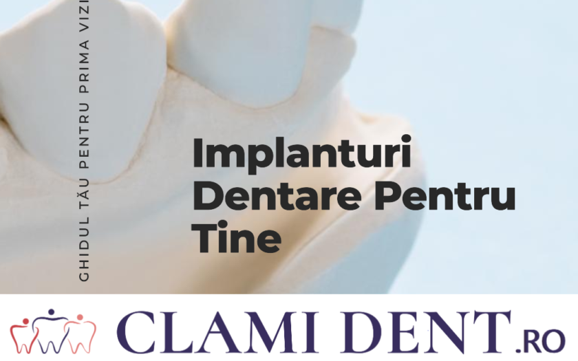 Implanturi Dentare Ghid Complet pentru Prima Vizită la Specialist