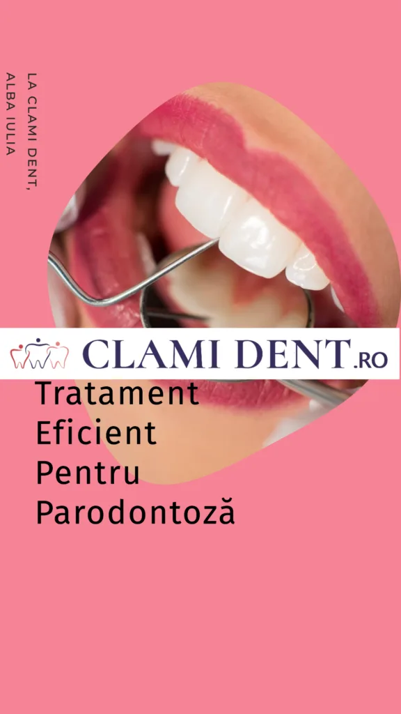 Tratament pentru parodontoza la Clami Dent din Alba Iulia