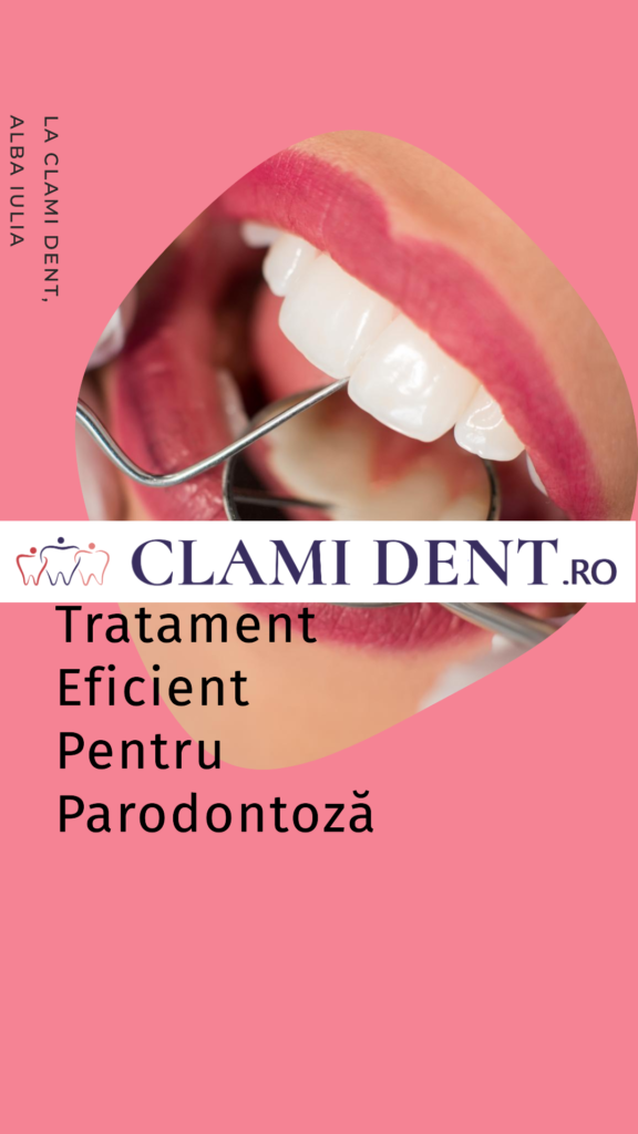 Tratament pentru parodontoza la Clami Dent din Alba Iulia