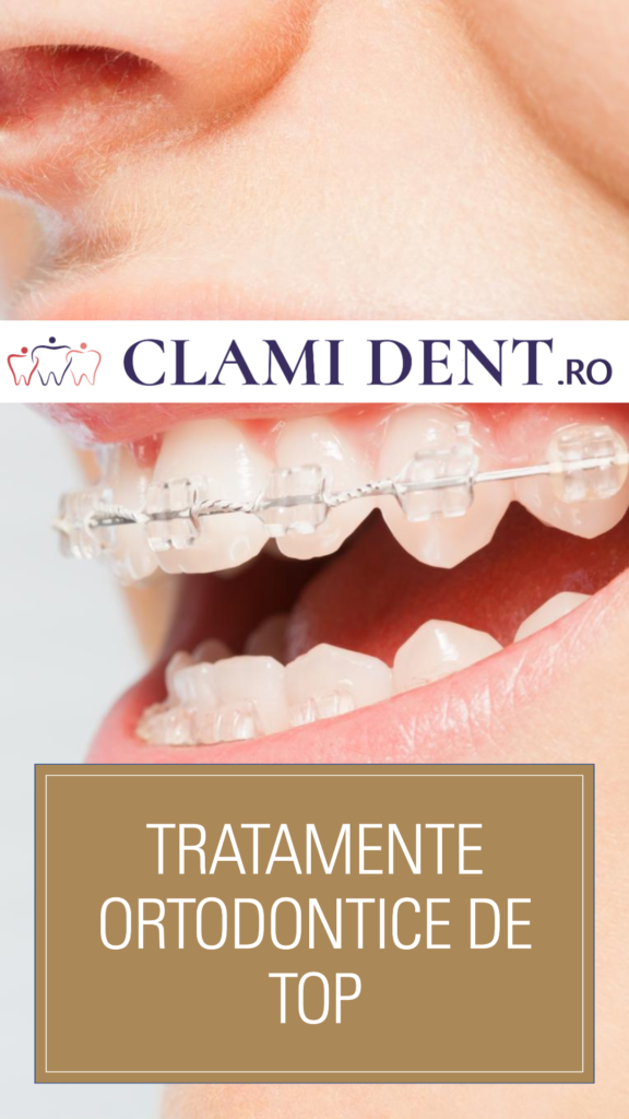 Tratamente ortodontice de top la Clami Dent din Alba Iulia