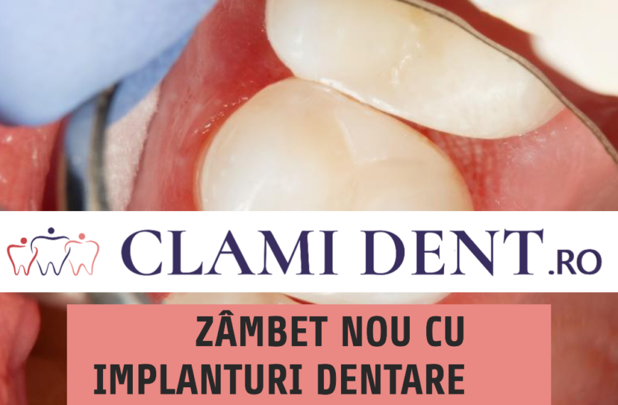 Zâmbet nou cu implanturi dentare la Clami Dent