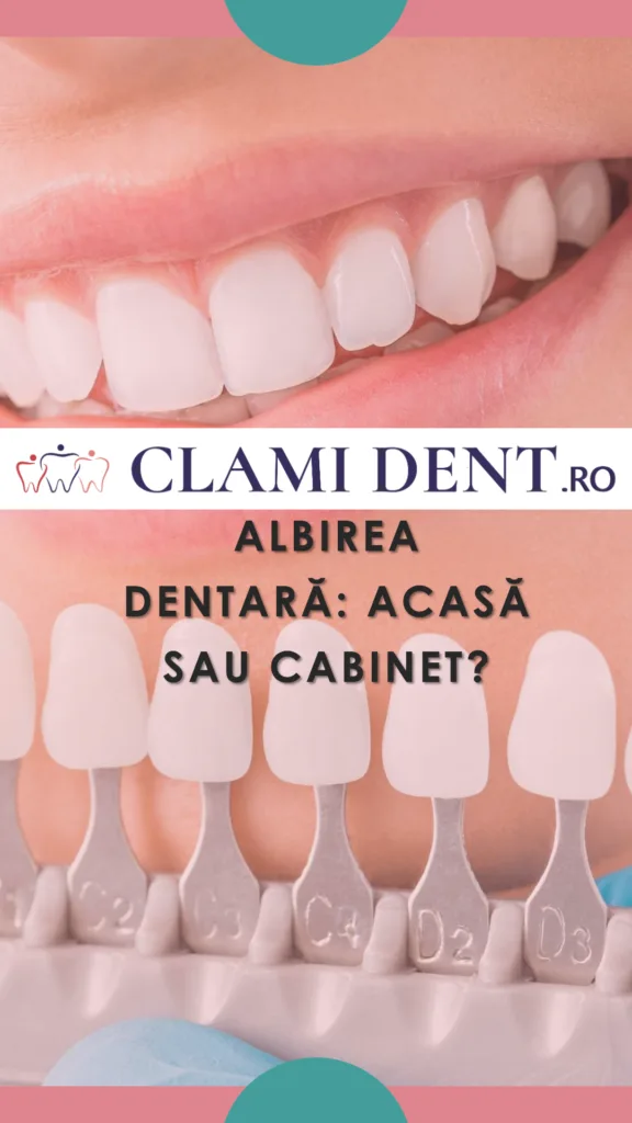 Albirea dentară acasă vs. în cabinet alba iulia