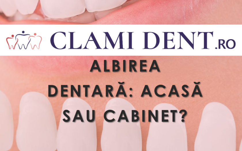 Albirea dentară acasă vs. în cabinet alba iulia