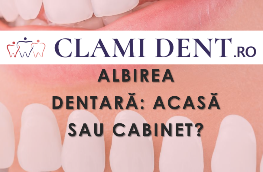 Albirea dentară acasă vs. în cabinet alba iulia