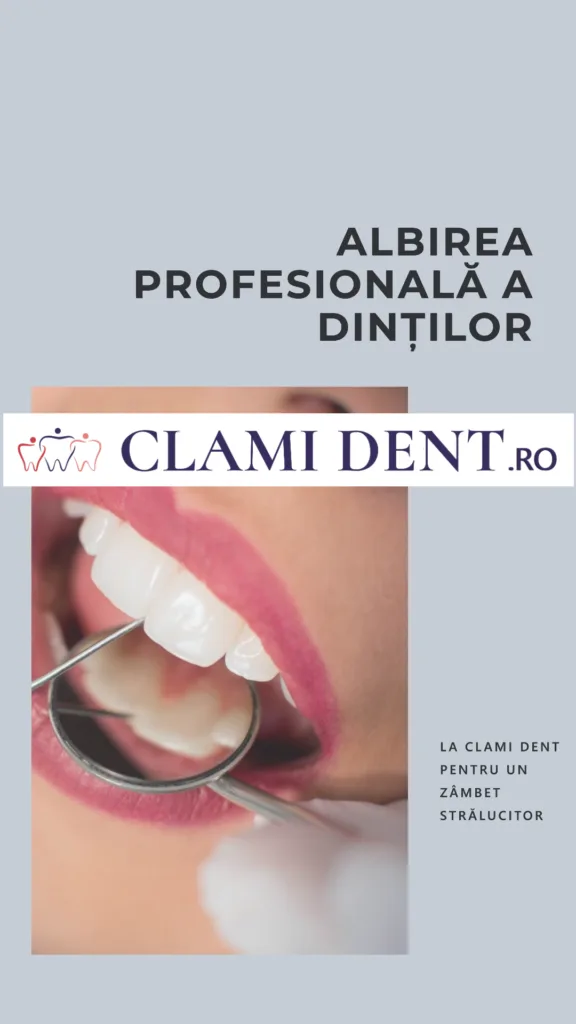 Albirea profesională a dinților Clami Dent Alba iulia
