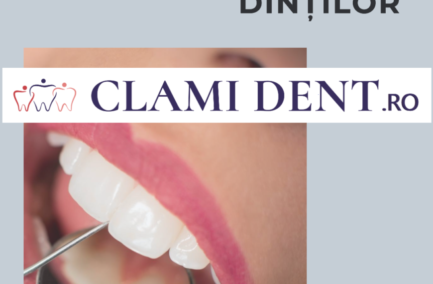 Albirea profesională a dinților Clami Dent Alba iulia
