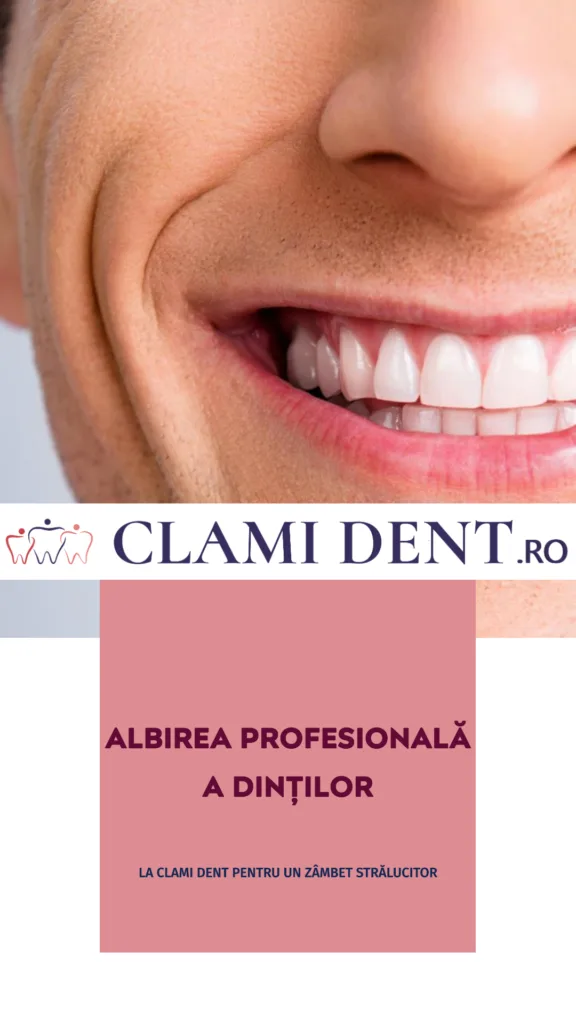 Albirea profesională a dinților la Clami Dent alba iulia