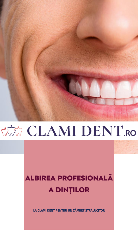 Albirea profesională a dinților la Clami Dent alba iulia
