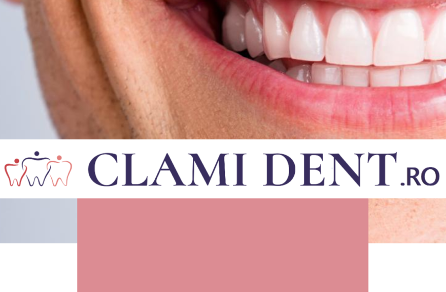 Albirea profesională a dinților la Clami Dent alba iulia