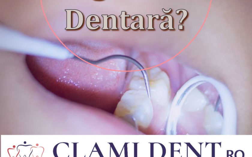 Ce este sigilarea dentară și când se recomandă Alba Iulia