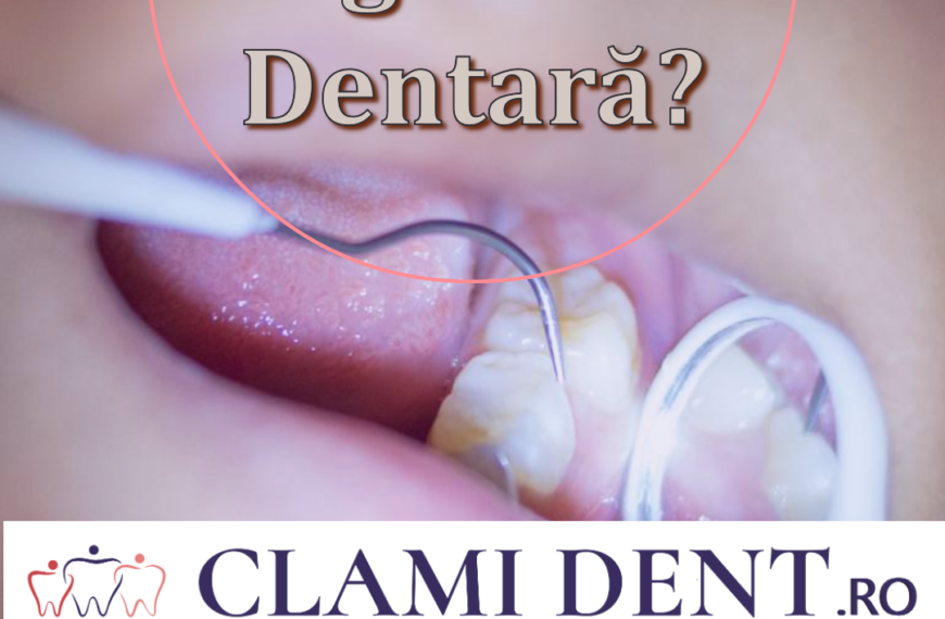 Ce este sigilarea dentară și când se recomandă Alba Iulia