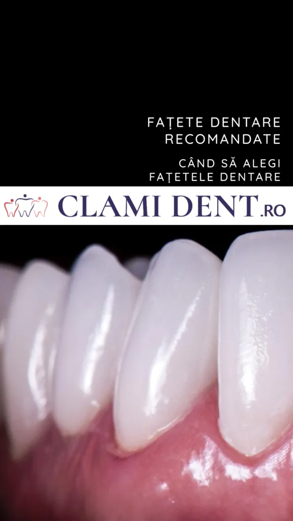 Fațete dentare când sunt recomandate Clami Dent Alba Iulia