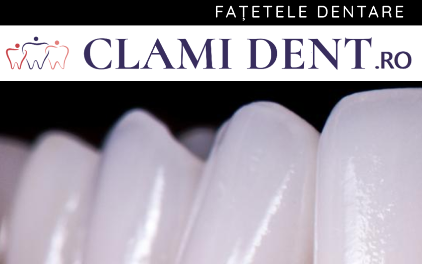 Fațete dentare când sunt recomandate Clami Dent Alba Iulia