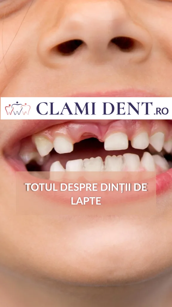 Totul despre dinții de lapte la copii Alba Iulia