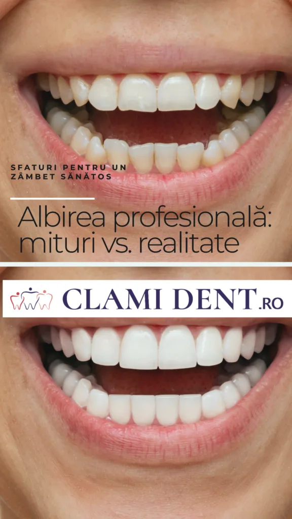Albirea profesională mituri vs. realitate