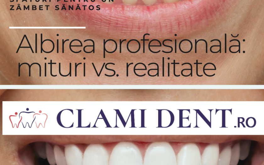 Albirea profesională mituri vs. realitate