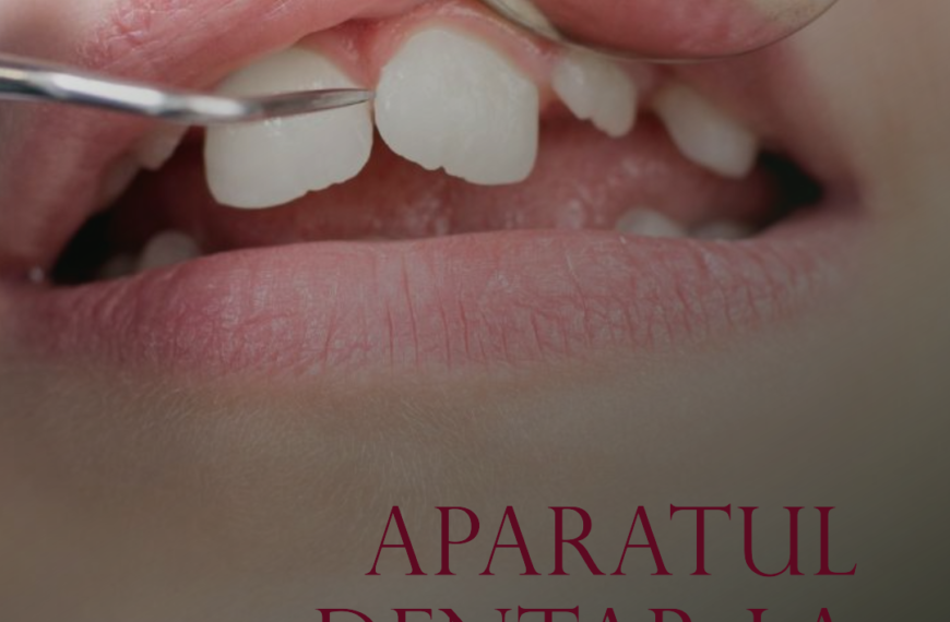 Aparatul dentar la copii când e momentul potrivit alba iulia