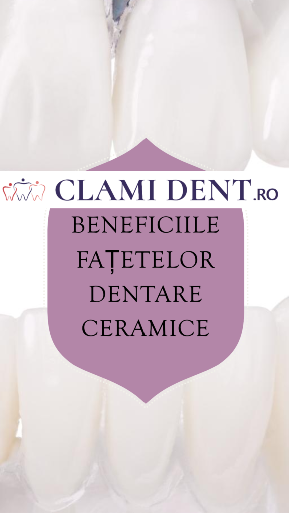 Beneficiile fațetelor dentare ceramice