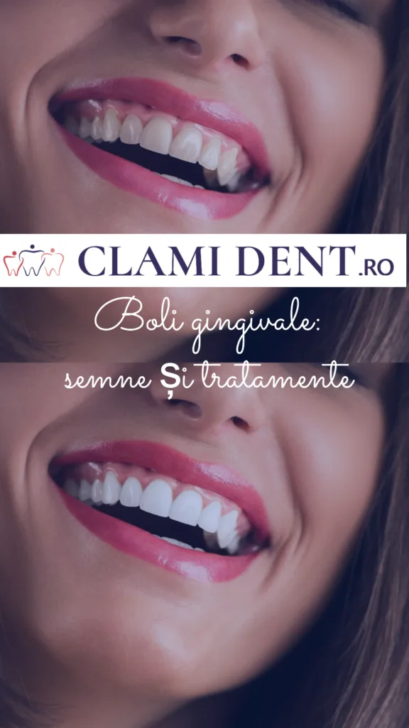 Boli gingivale semne și tratamente