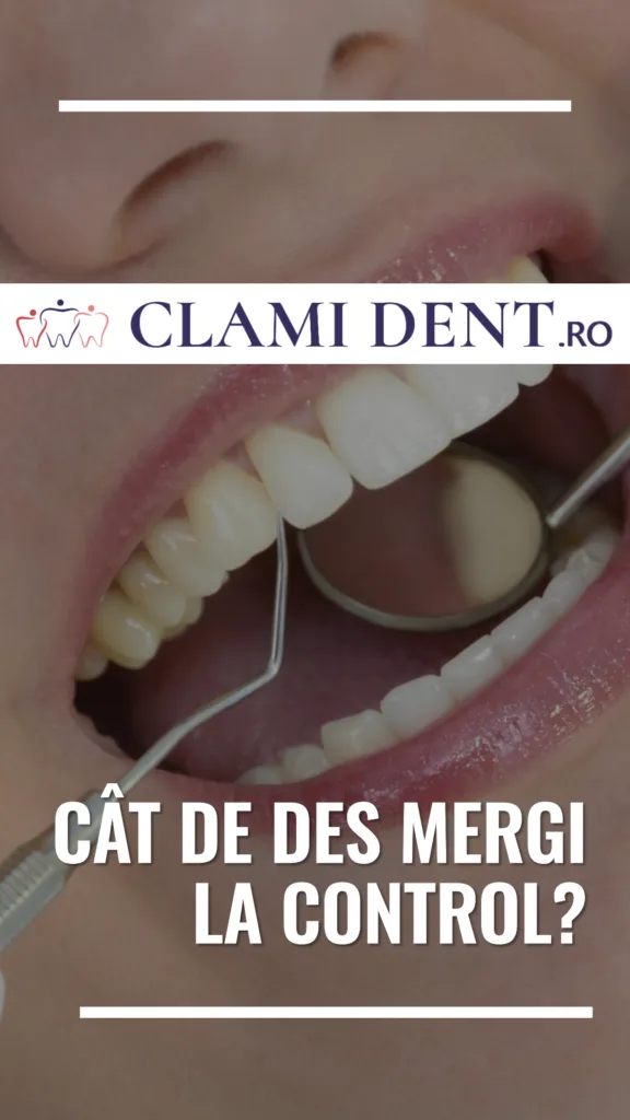 Cât de des mergi la control stomatologic