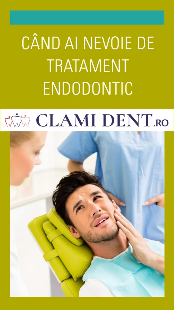 Când Ai Nevoie De Tratament Endodontic