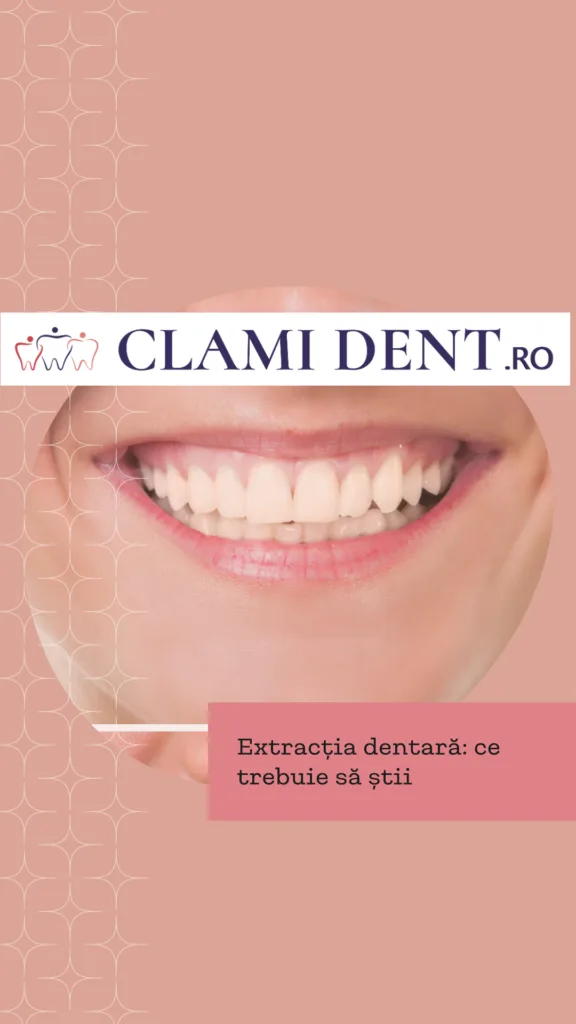 Extracția dentară ce trebuie să știi