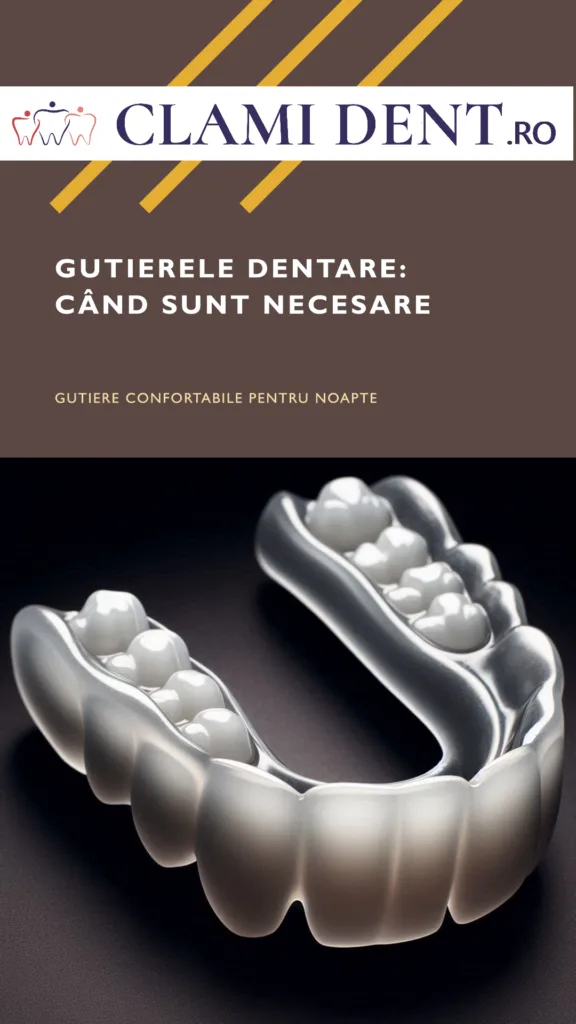 Gutierele dentare când sunt necesare (2)