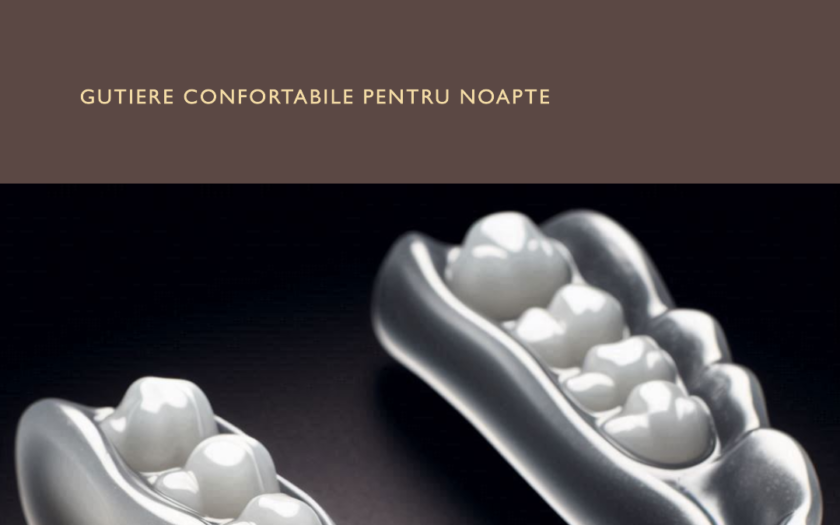 Gutierele dentare când sunt necesare (2)