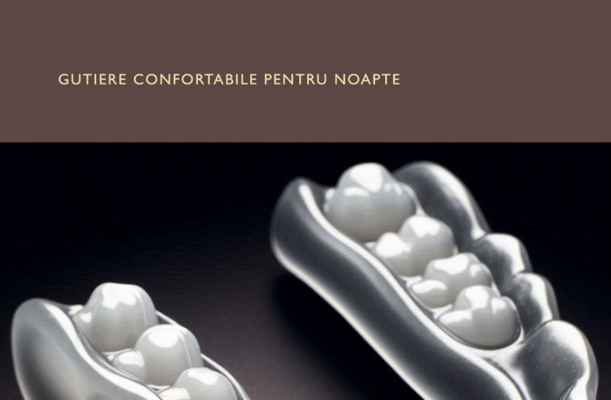 Gutierele dentare când sunt necesare (2)