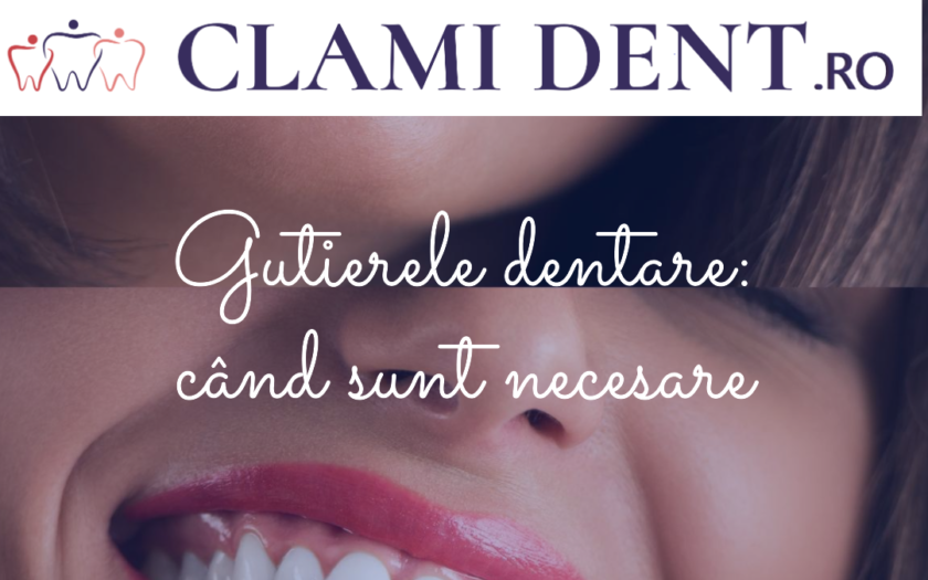 Gutierele dentare când sunt necesare