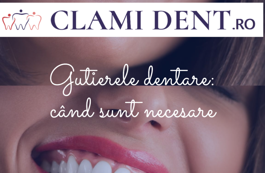 Gutierele dentare când sunt necesare