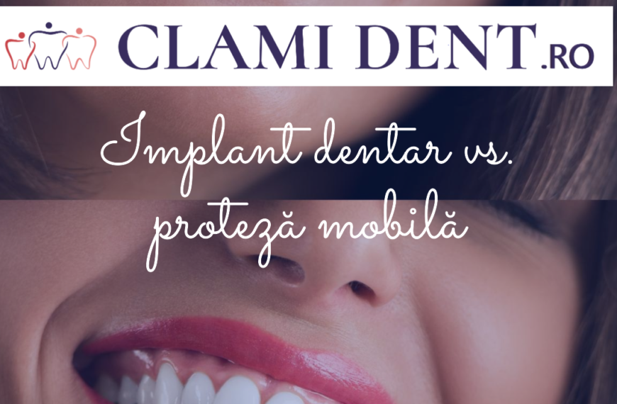 Implant dentar vs. proteză mobilă alba iulia