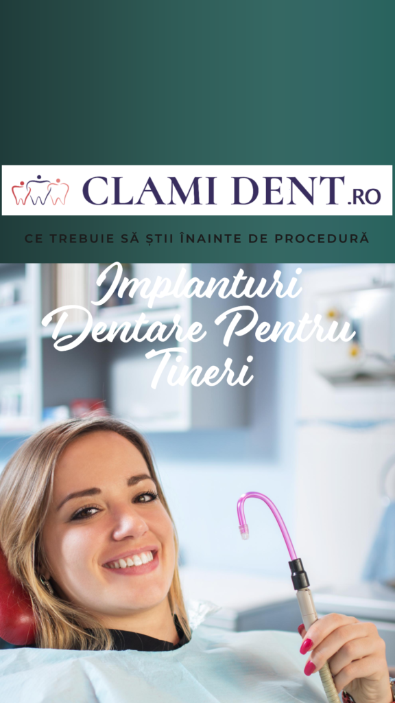 Implanturi dentare la tineri ce trebuie știut