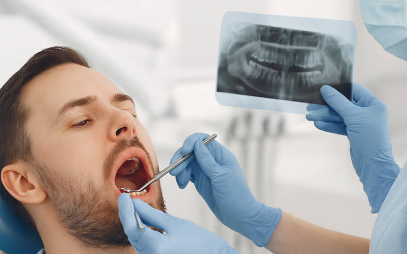 Ce este parodontoza și cum o previi Dentist Alba Iulia