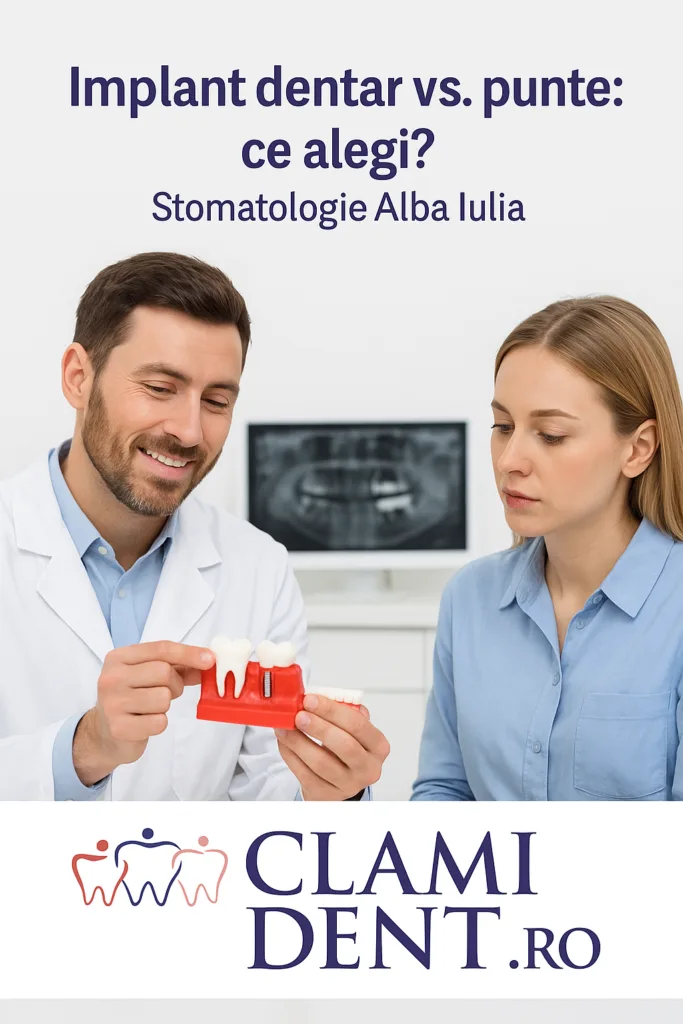 Implant dentar vs. punte ce alegi - Stomatologie Alba Iulia