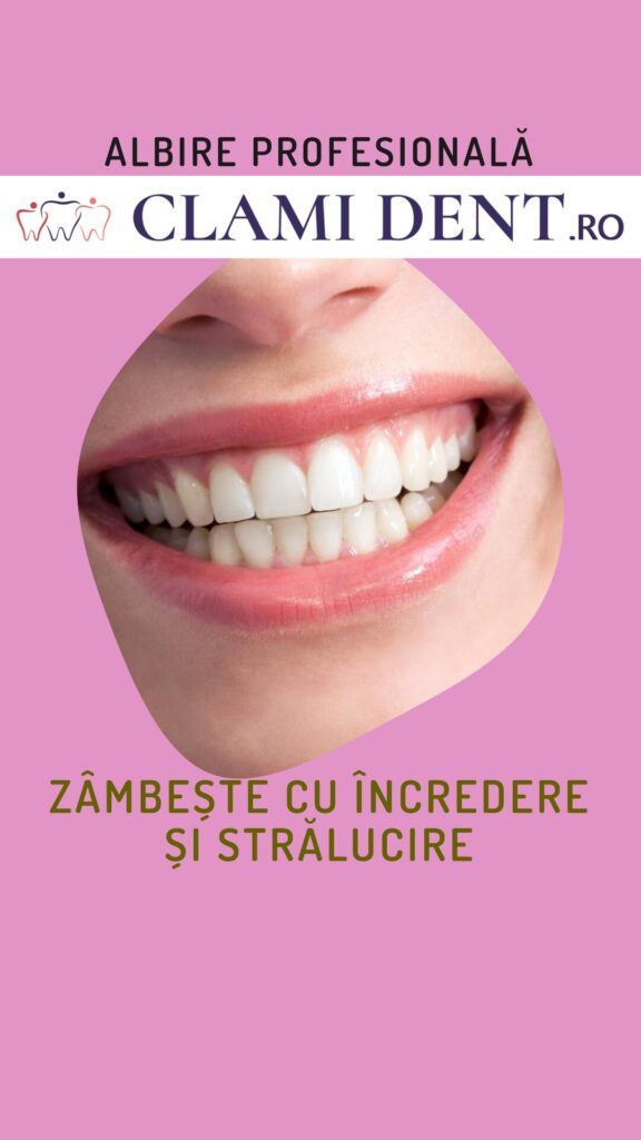 Albire profesională dinți la Clami Dent