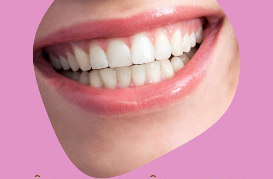 Albire profesională dinți la Clami Dent