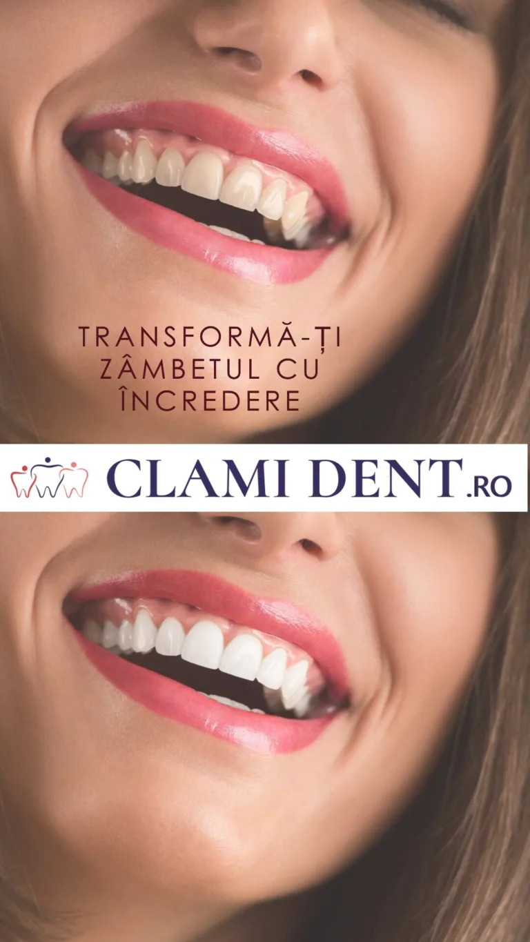 Igiena bucala si prevenirea cariilor la adulti: obiceiuri simple pentru un zambet sanatos